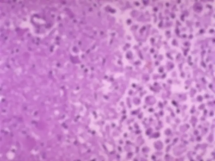 pf42