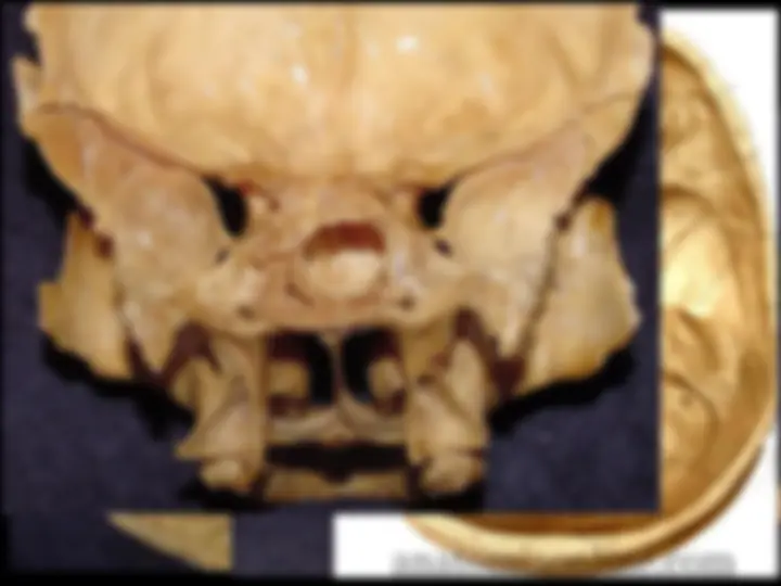 pf48