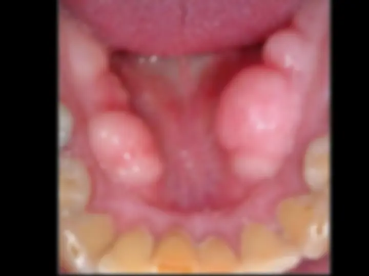 pff