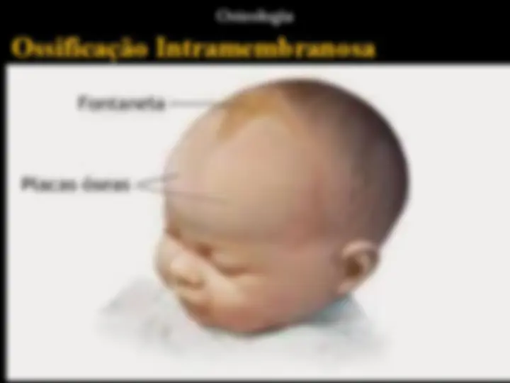 pf1a