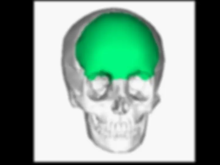 pf4e
