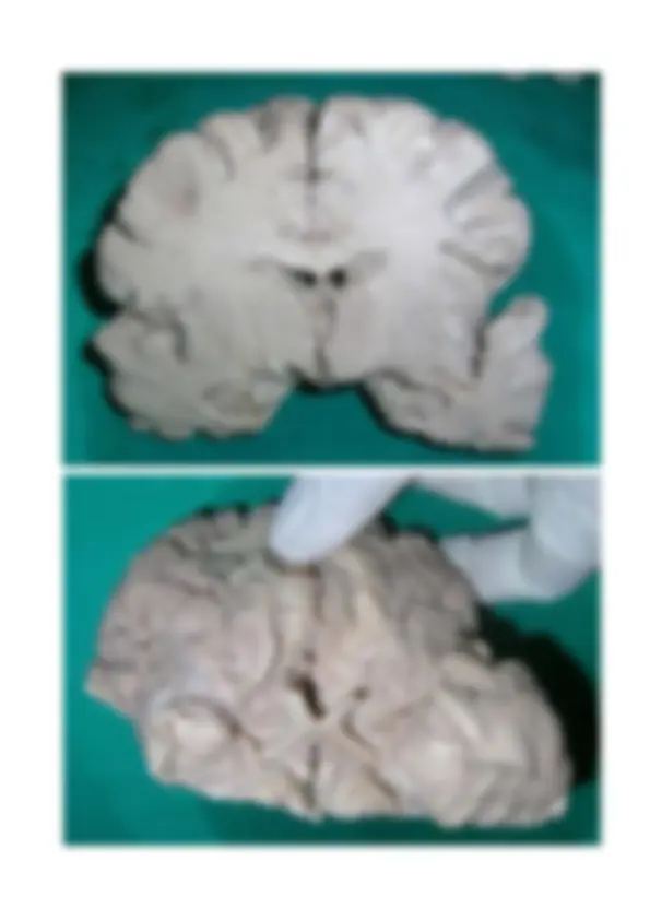 pfa
