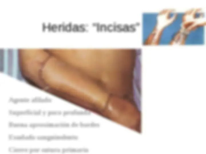 pf14