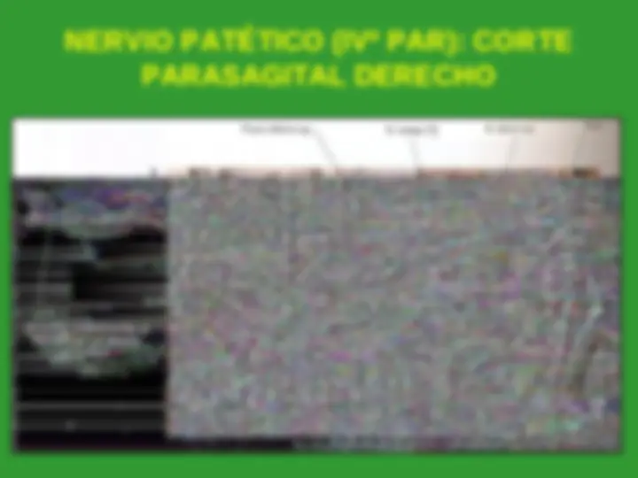 pf12