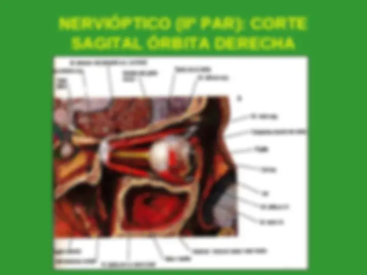 pfa