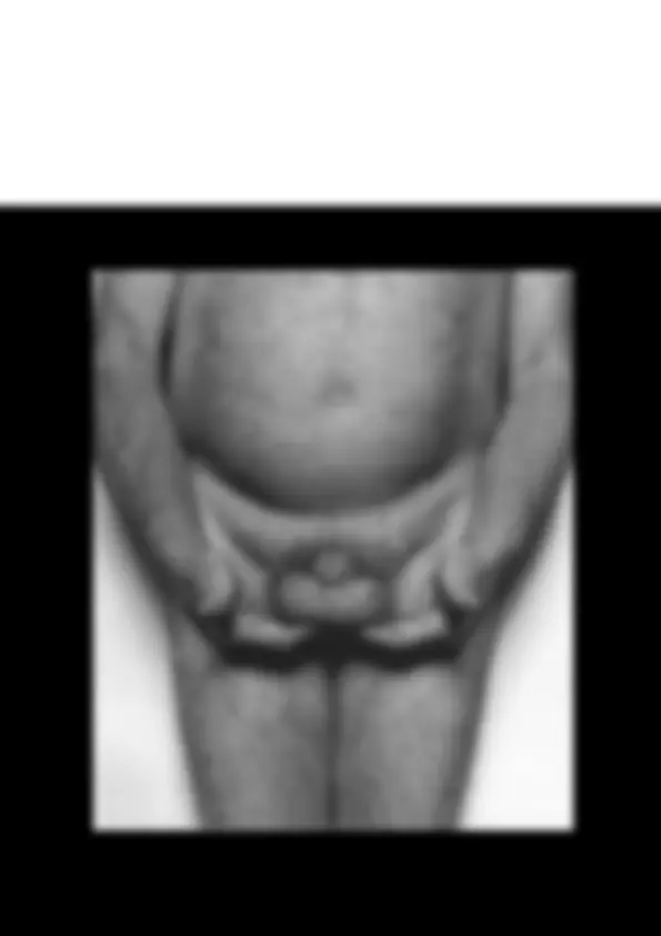 pfa