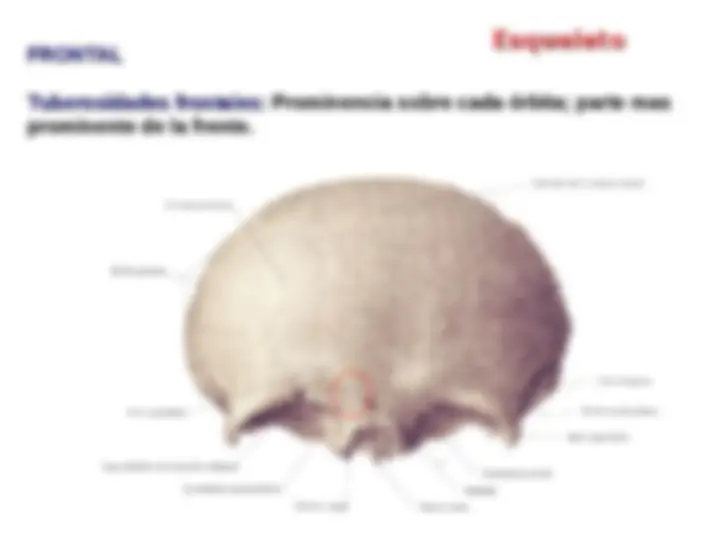 pf1e
