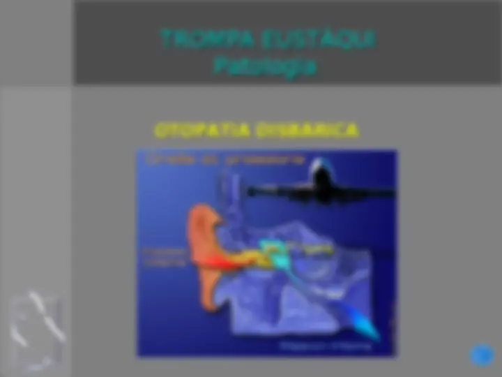 pf1a