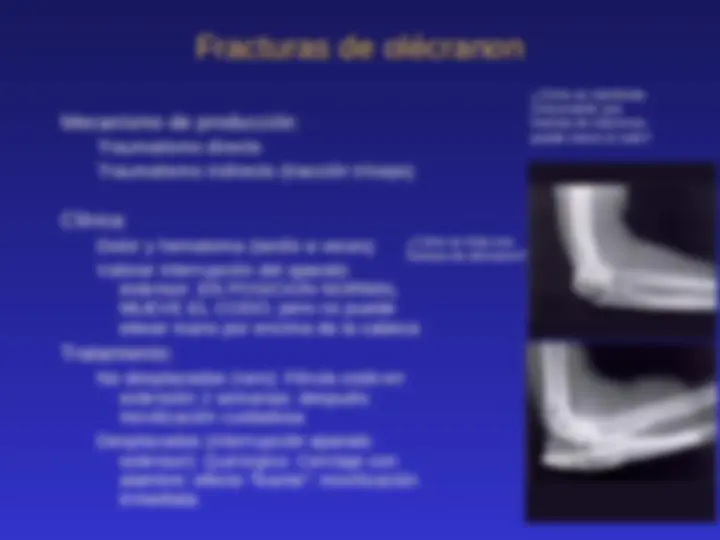 pf1b