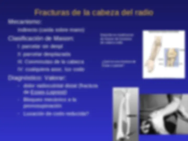 pf1c