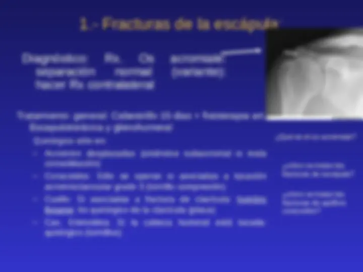 pf5