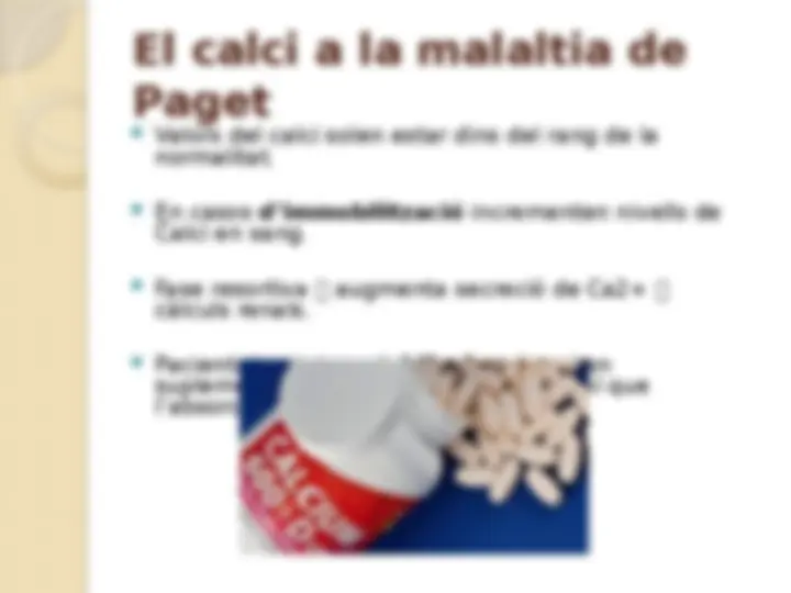 pfe