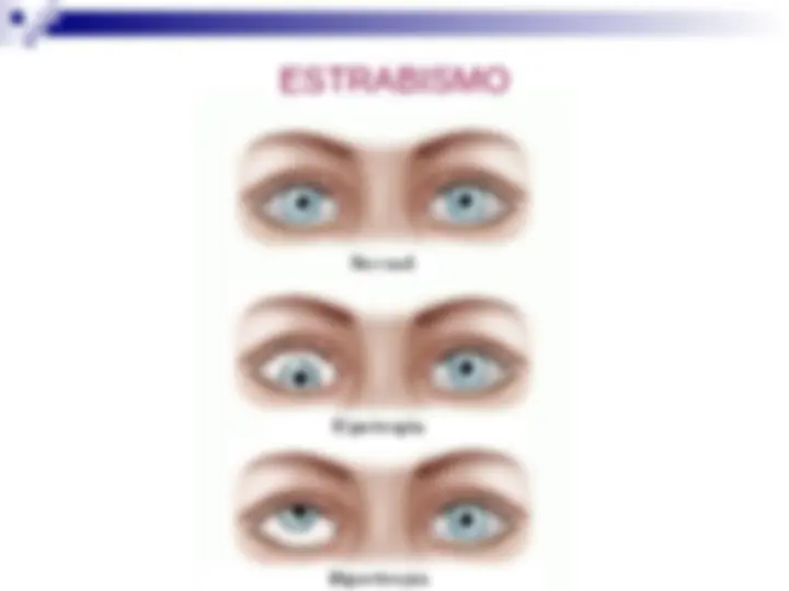 pfe