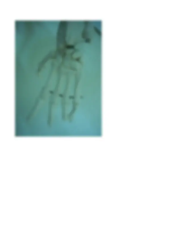 pf4