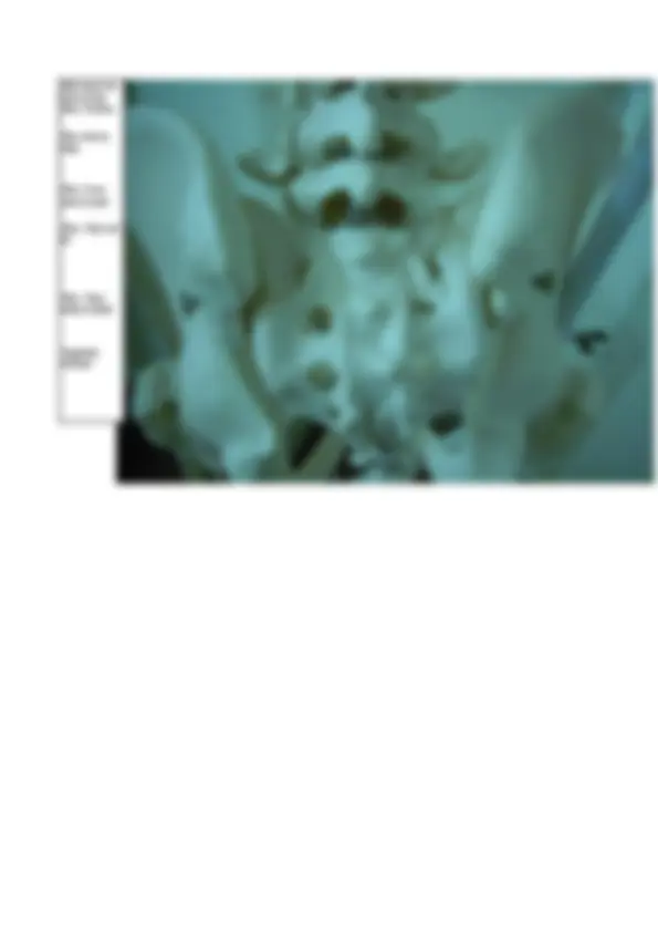 pfa