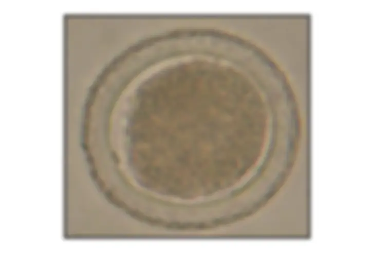 pf1b