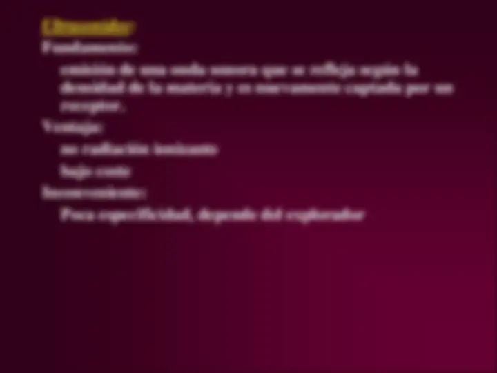 pfe