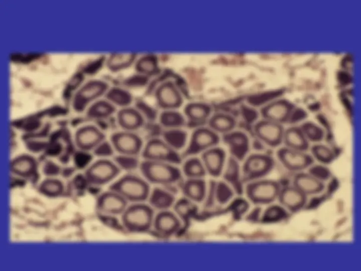 pf1b