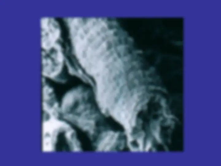 pf24