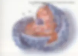 pf1e