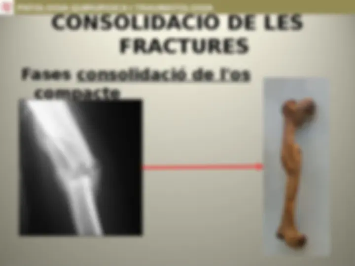 pf13