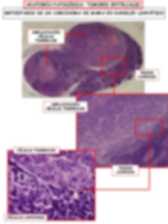 pf5