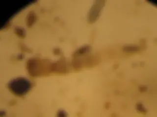 pf15