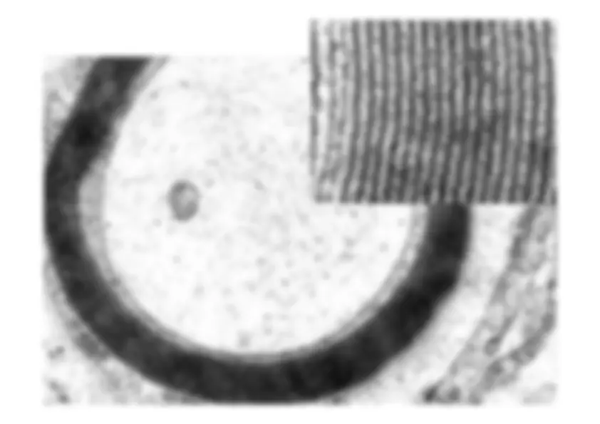 pf1c