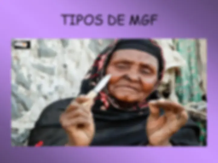 pf4d
