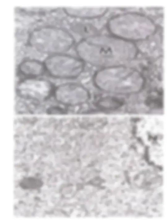 pf1b