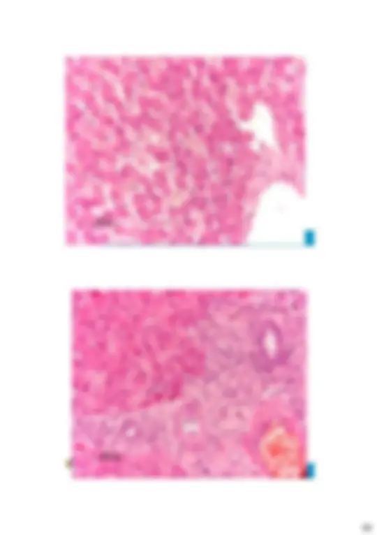 pf32