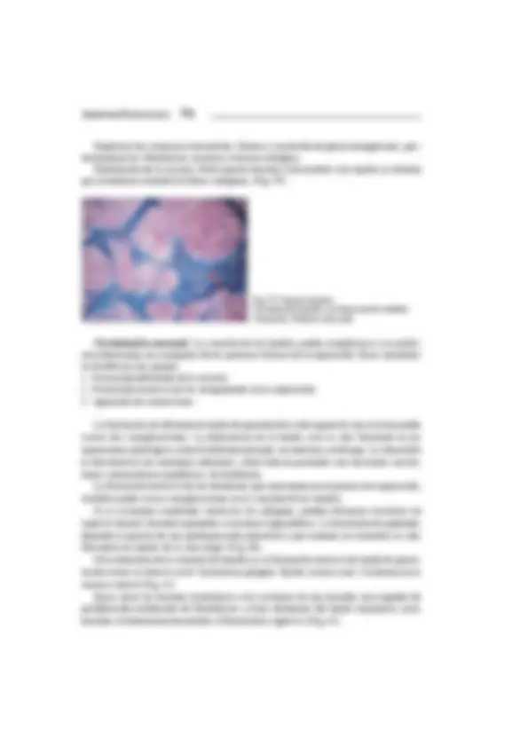 pf4d