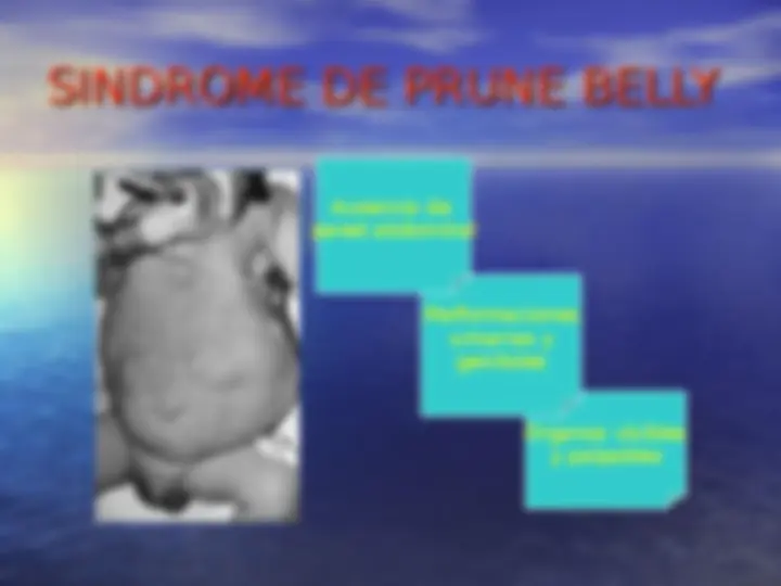 pf13
