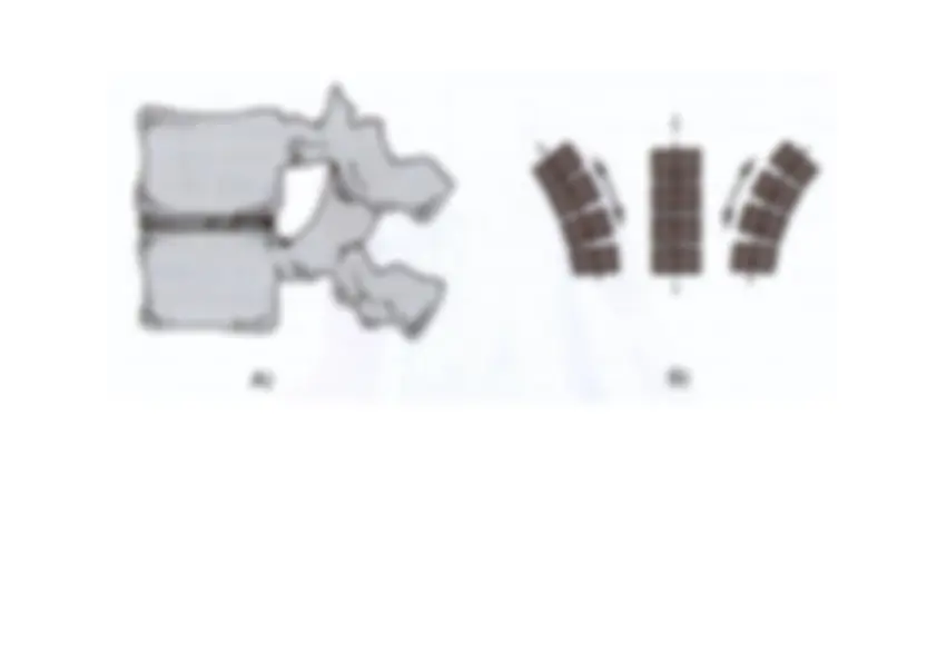 pf1c