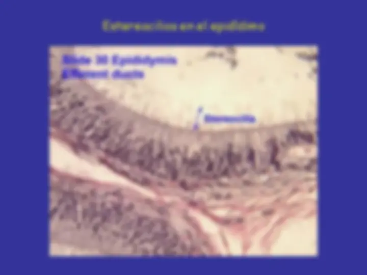 pf1b