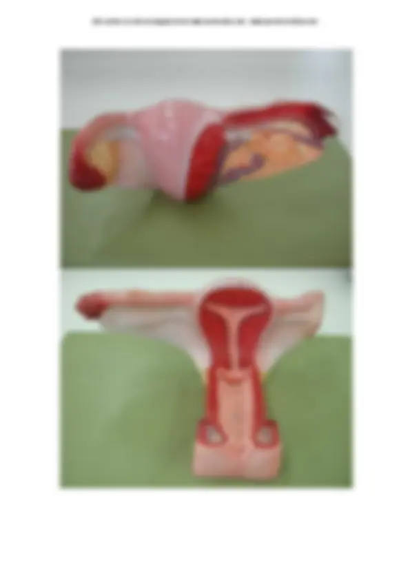 pf43