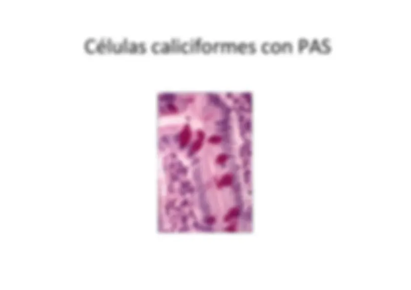 pf5