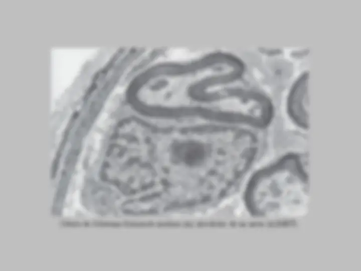 pf15