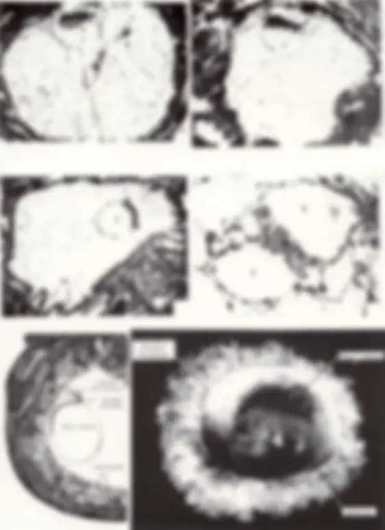 pf5