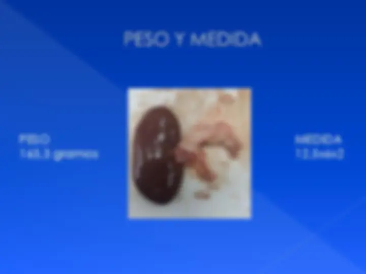 pf3