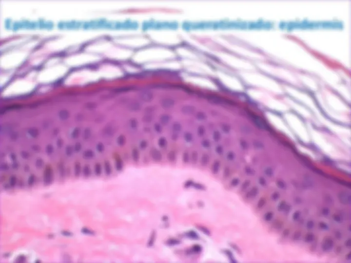pf38