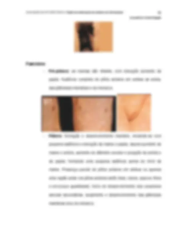 pf4f
