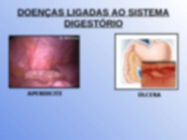 pf14