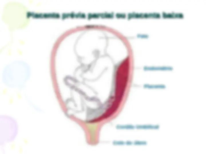 pf4