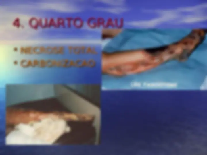 pfe