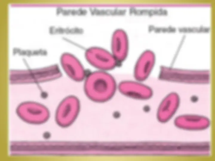 pf35