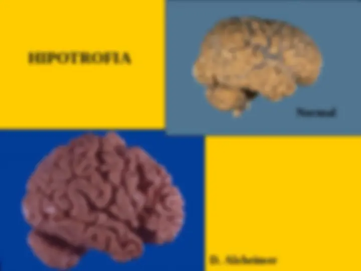 pff