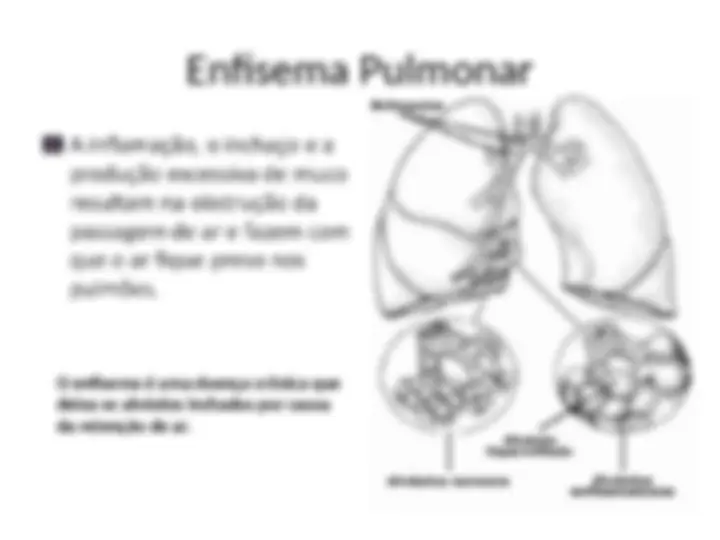 pfe