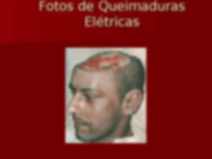 pf17