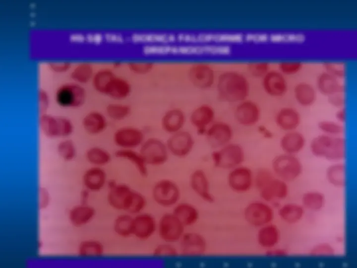 pf15